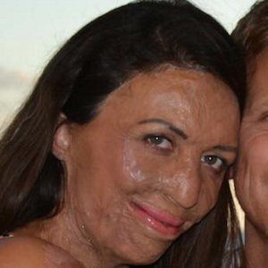 Turia Pitt