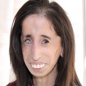 Lizzie Velasquez